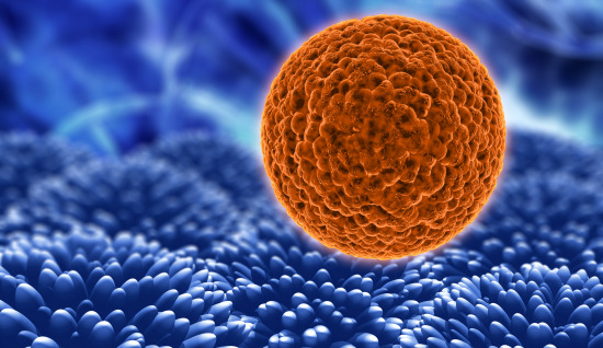 OTOLOG FİBROBLAST KÖK HÜCRE TRANSFERİ